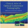 CLINICAL ATLAS OF OPTICAL COHERENCE TOMOGRAPHY UPDATED FOR SWEPT SOURCE IMAGING UPMED