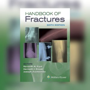 Handbook of Fractures