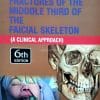 Killeys Fracture of the Middle Third of the Facial Skeleton 6th Edition