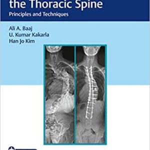 Surgery of the Thoracic Spine Principles and Techniques