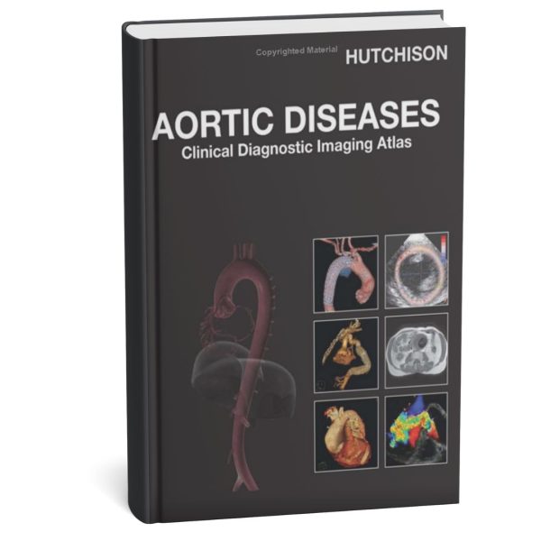 Aortic Diseases: Clinical Diagnostic Imaging Atlas