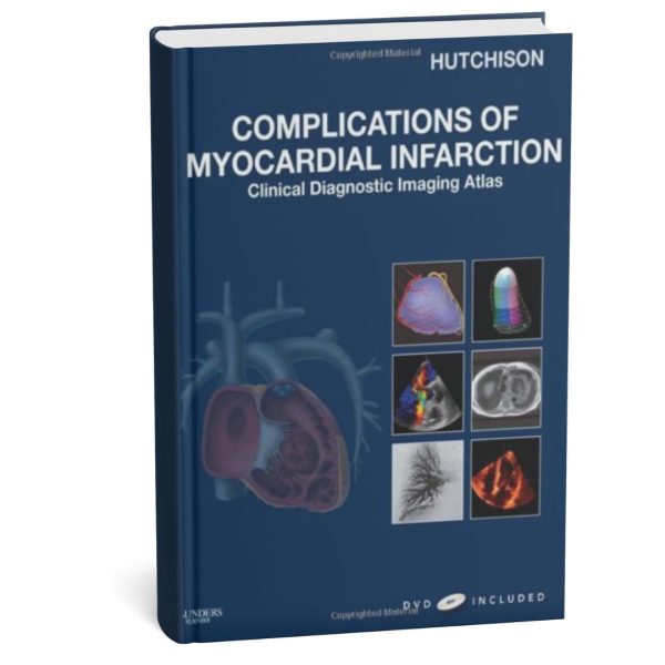 Complications of Myocardial Infarction: Clinical Diagnostic Imaging Atlas