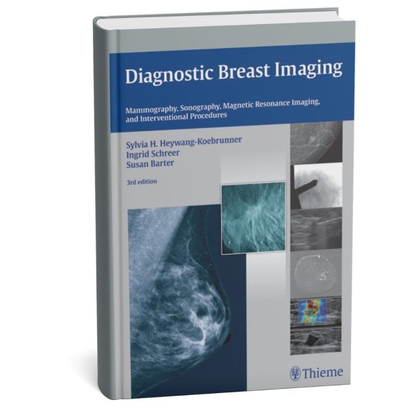 Diagnostic Breast Imaging