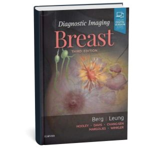 Diagnostic Imaging Breast