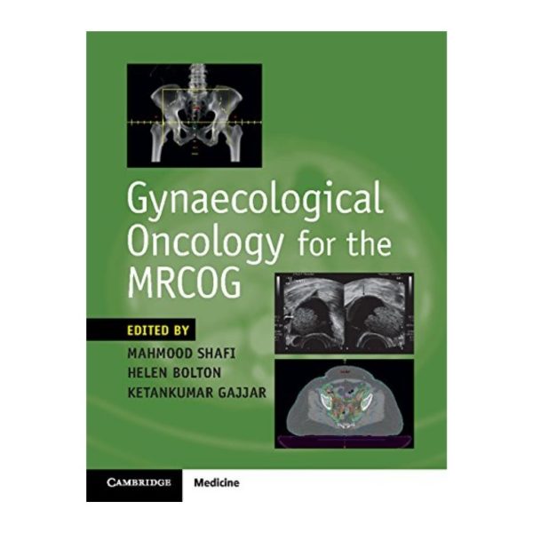 Gynaecological Oncology for the MRCOG