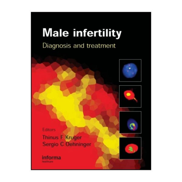 Male Infertility: Diagnosis and Treatment