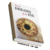 Parson Eye CB 650