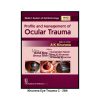 Strabismus pradeep CB 464 2