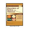 Disorders of Retina and Vitreous (Modern System of Ophthalmology Series) 3 Tyagi Gross Path0 CB 300 3