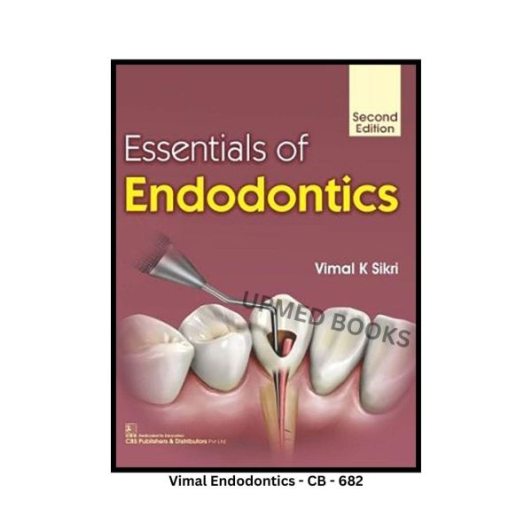 Essentials of Endodontics, 2nd Edition