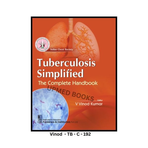 Tuberculosis Simplified: The Complete Handbook