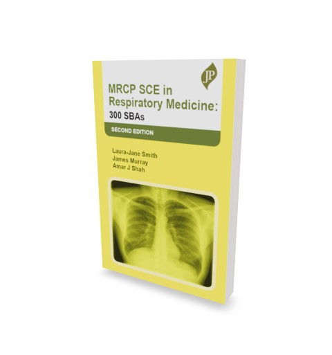MRCP SCE in Respiratory Medicine 300 SBAs 1 MRCP SCE in Respiratory Medicine 300 SBAs