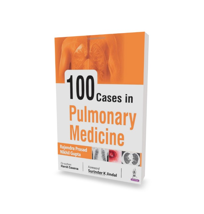 100 Cases in Pulmonary Medicine 1 100 Cases in Pulmonary Medicine