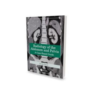 Radiology of the Abdomen and Pelvis: A Case-Based Guide by Swati Goyal