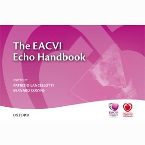 The EACVI Echo Handbook