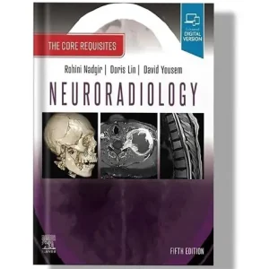 Neuroradiology The Core Requisites