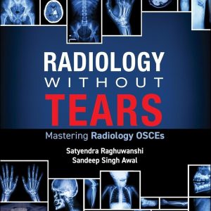 Radiology Without Tears: Mastering Radiology OSCEs